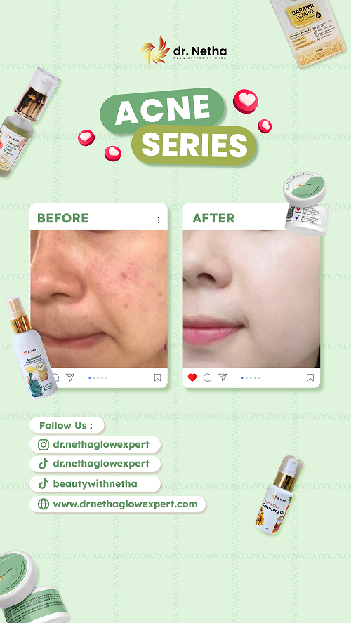 Foto Testimoni dr. Netha Glow Expert 5